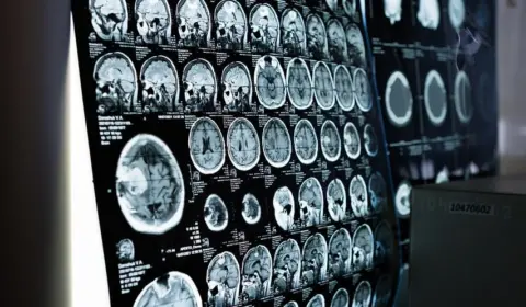 Miguel Nicolelis explora a complexidade do cérebro humano em novo curso
