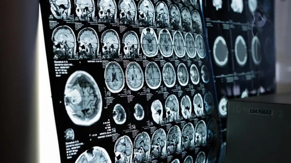 Miguel Nicolelis explora a complexidade do cérebro humano em novo curso
