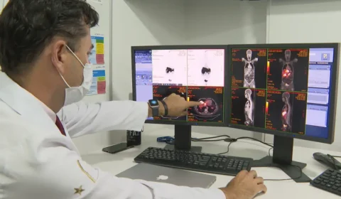Estudo identifica principal fator de câncer de cólon entre jovens
