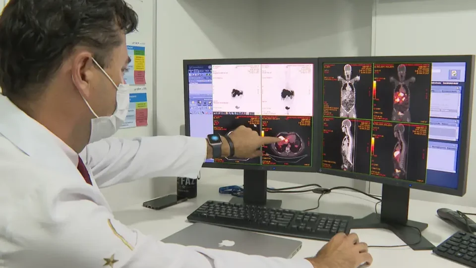 Estudo identifica principal fator de câncer de cólon entre jovens