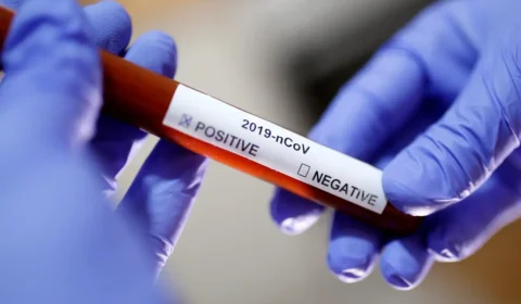 No Brasil, testes positivos para covid sobem de 9% para 17,5% em um mês