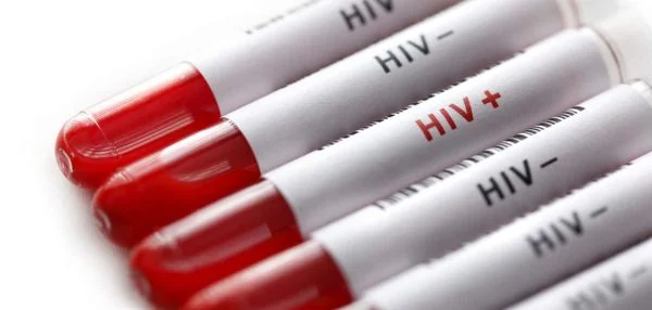 MPRJ firma acordo para indenizar pacientes que receberam órgãos com HIVAcordo visa garantir reparação aos pacientes transplantados com órgãos contaminados com o vírus HIV