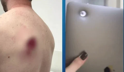 Notebook na mochila salva motociclista baleado em assalto na zona oeste de SP