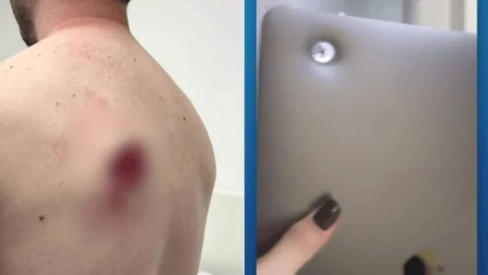 Notebook na mochila salva motociclista baleado em assalto na zona oeste de SP