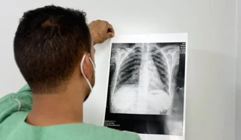 Novo tratamento reduz risco de morte em tipo de câncer de pulmão que atinge mais mulheres