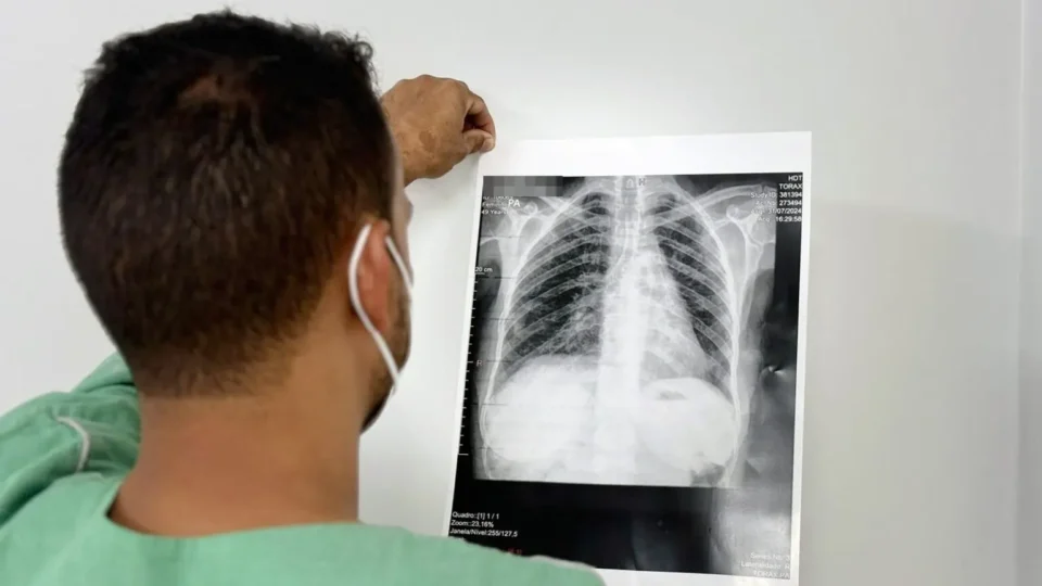Novo tratamento reduz risco de morte em tipo de câncer de pulmão que atinge mais mulheres