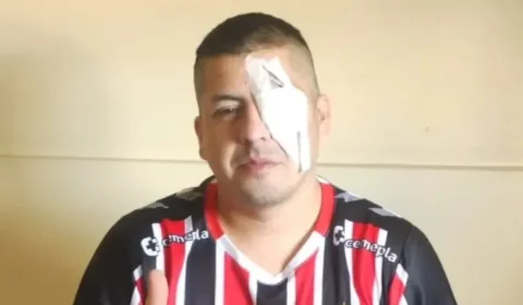 Torcedor que perdeu olho atingido por polícia em manifestação vai processar ministra de Milei