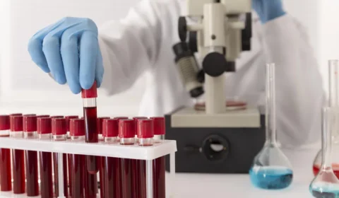 Parkinson: Pesquisa descobre meio de diagnosticar doença antes dos sintomas surgirem