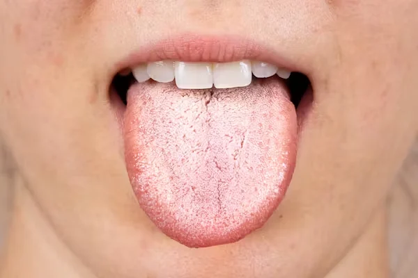 boca