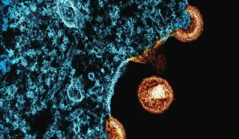 Cientistas desenvolvem nanopartículas de mRNA que podem levar à cura do HIV