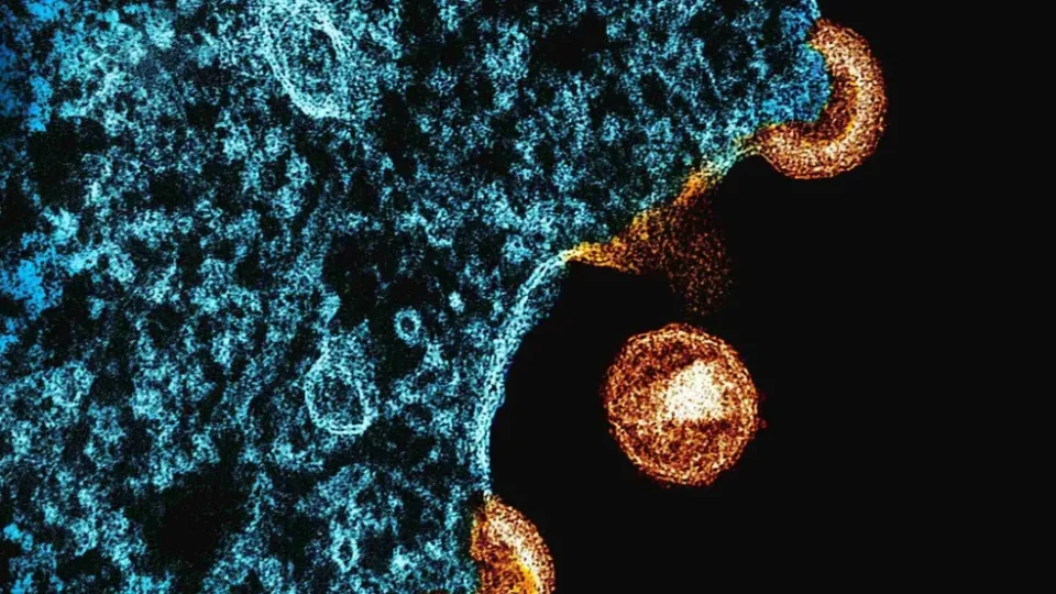 Cientistas desenvolvem nanopartículas de mRNA que podem levar à cura do HIV