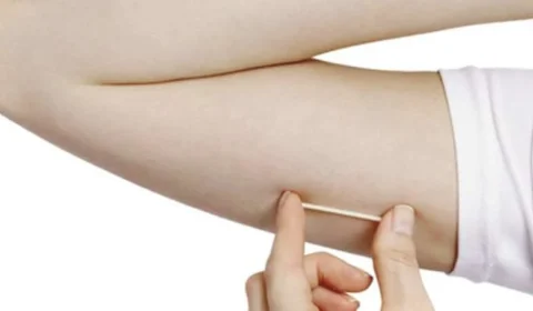 Saúde anuncia que SUS oferecerá implante contraceptivo de alta eficácia