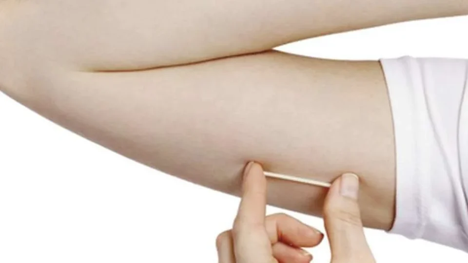 Saúde anuncia que SUS oferecerá implante contraceptivo de alta eficácia