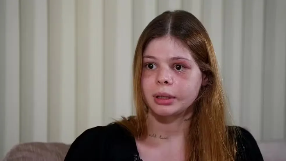 Samira deu sua primeira entrevista após o evento traumático (Foto: Reprodução)