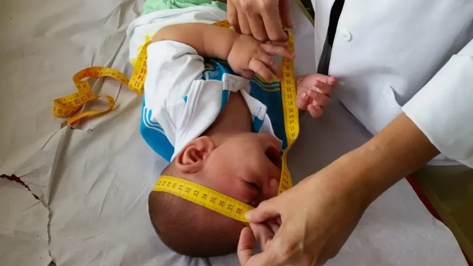 Crescimento da cabeça do bebê pode influenciar QI na fase adulta, mostra estudo