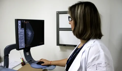 Mamografias pelo SUS alcançam menos de 40% das mulheres de 50 a 69 anos