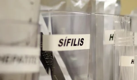 Sífilis continua em ritmo acelerado de crescimento no país
