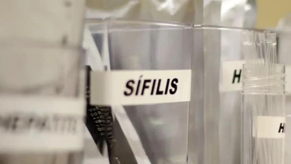Sífilis continua em ritmo acelerado de crescimento no país
