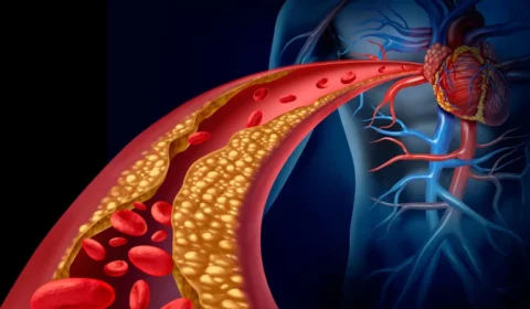 Veja seis alimentos que ajudam a controlar o colesterol no sangue
