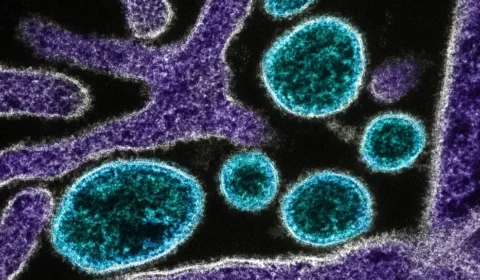 Nipah não tem potencial pandêmico e risco no Brasil é baixo, diz infectologista