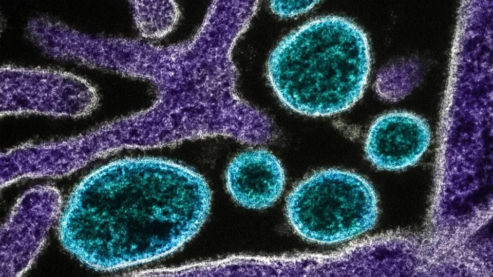 Nipah não tem potencial pandêmico e risco no Brasil é baixo, diz infectologista
