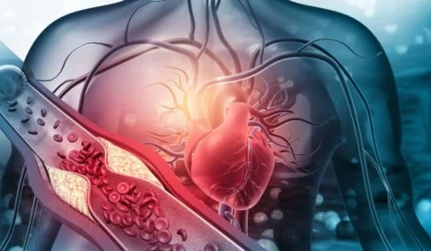 Conheça seis alimentos que ajudam a controlar os níveis de colesterol