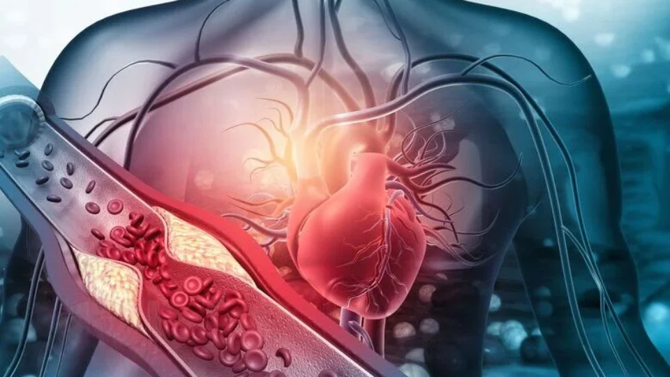 Conheça seis alimentos que ajudam a controlar os níveis de colesterol