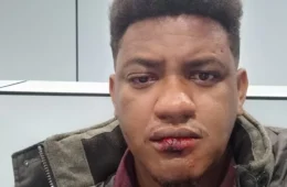 MP de Portugal denuncia três homens por agressão a brasileiros negros