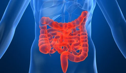 Veja cinco frutas que ajudam na saúde do intestino, segundo especialistas