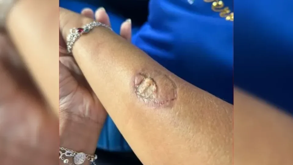 Mãe de aluno agride funcionárias e morde vice-diretora em escola no PR