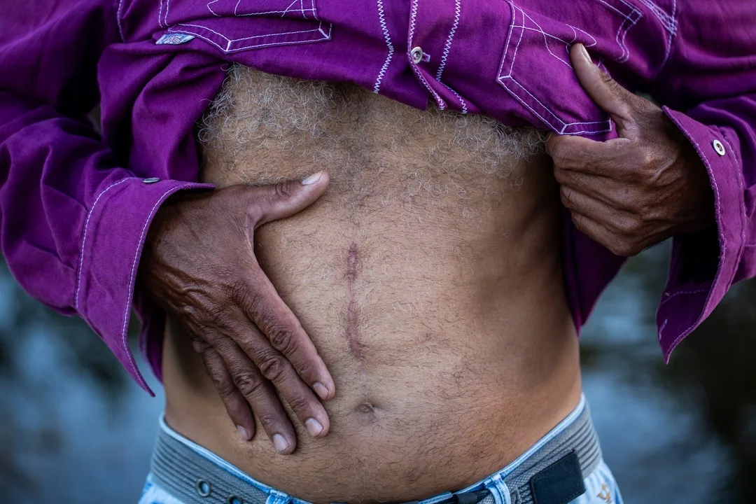 Trabalho escravo responde por 52% dos conflitos fundiários no Brasil