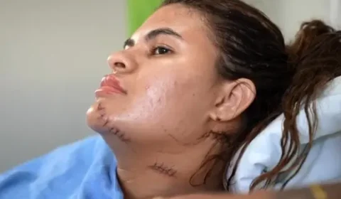 ‘Me fiz de morta’, diz mulher que teve mãos amputadas em ataque com foice no Ceará