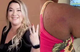 ‘Fez isso para me incriminar e não pagar o serviço’, diz empregada vítima de agressão