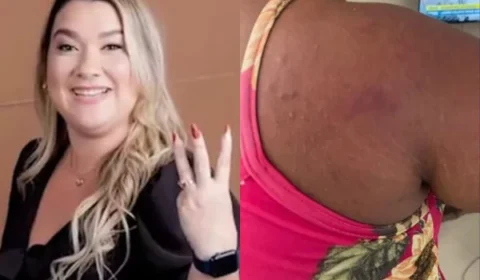 ‘Fez isso para me incriminar e não pagar o serviço’, diz empregada vítima de agressão