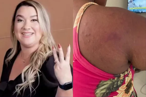 Carolina Sthela Ferreira dos Anjos | Hematoma da vítima (Reprodução/Redes sociais | Divulgação/PCMA)