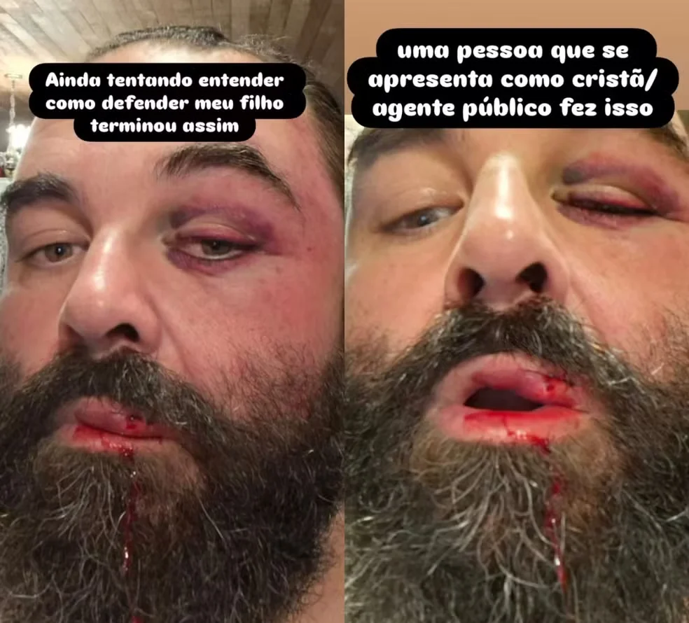 Vítima mostrou ferimentos em publicação nas redes sociais — Foto: Redes sociais/ Reprodução