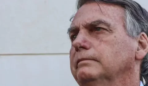 Bolsonaro tem alta de hospital e volta para prisão domiciliar após cirurgia no ombro
