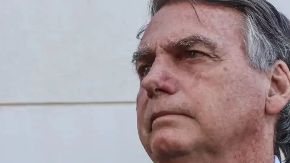 Bolsonaro tem alta de hospital e volta para prisão domiciliar após cirurgia no ombro