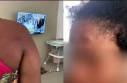 Empregada grávida agredida por ex-patroa diz que tentou proteger bebê durante ataques