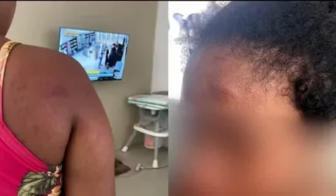 Empregada grávida agredida por ex-patroa diz que tentou proteger bebê durante ataques