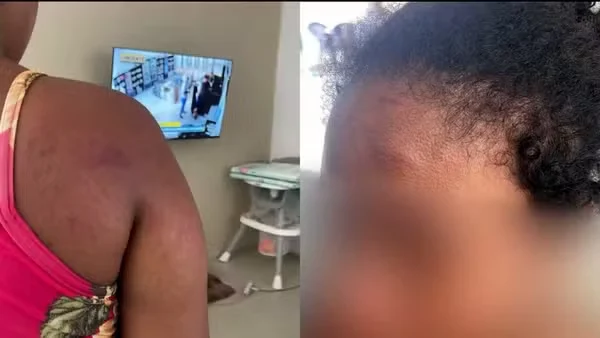 Doméstica grávida agredida por ex-patroa no MA diz que tentou proteger bebê durante ataques