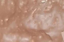 Ferrero é condenada após crianças consumirem Kinder Ovo com larvas em MG