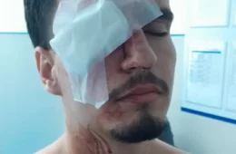 Estudante fica cego após ser atingido por tiro de bala de borracha no Maracanã