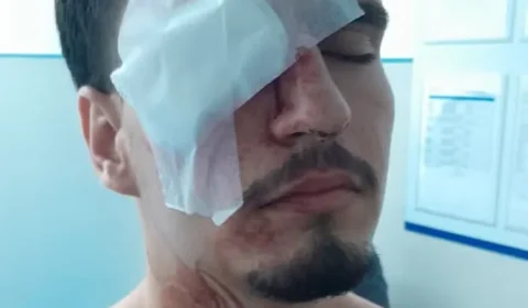 Estudante fica cego após ser atingido por tiro de bala de borracha no Maracanã