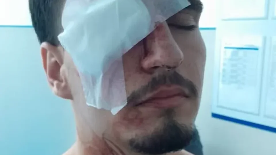 Estudante fica cego após ser atingido por tiro de bala de borracha no Maracanã