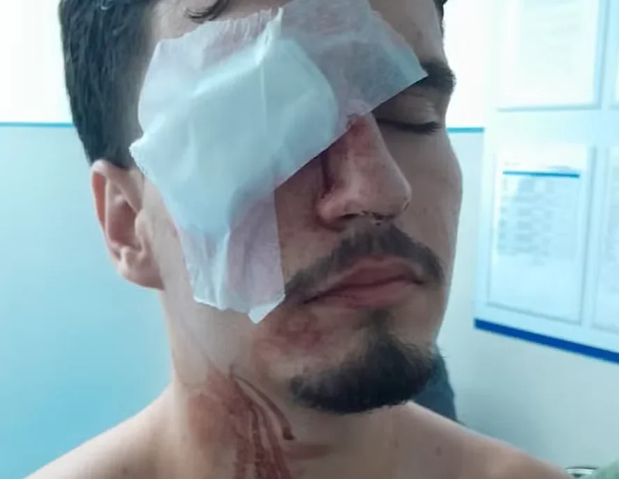 Estudante fica cego após ser atingido por tiro de bala de borracha no Maracanã