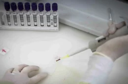 Secretaria de Saúde de SP investiga novo caso suspeito de ebola