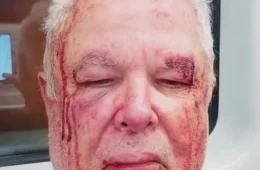 Polícia investiga agressão a idoso por motivação política em Copacabana (RJ)