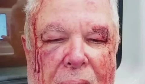 Polícia investiga agressão a idoso por motivação política em Copacabana (RJ)