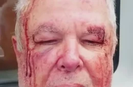 Vítima de violência política no Rio só conseguiu fazer perícia após ir à Corregedoria